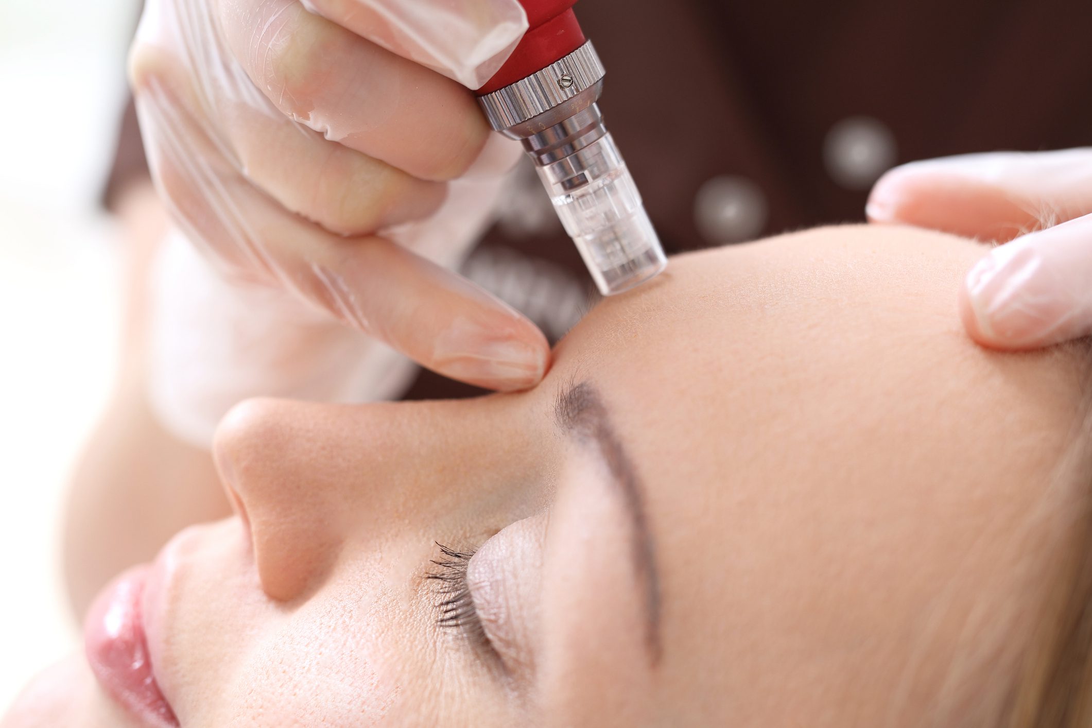 Needle mesotherapy treatment aesthetic execution in the beauty salon