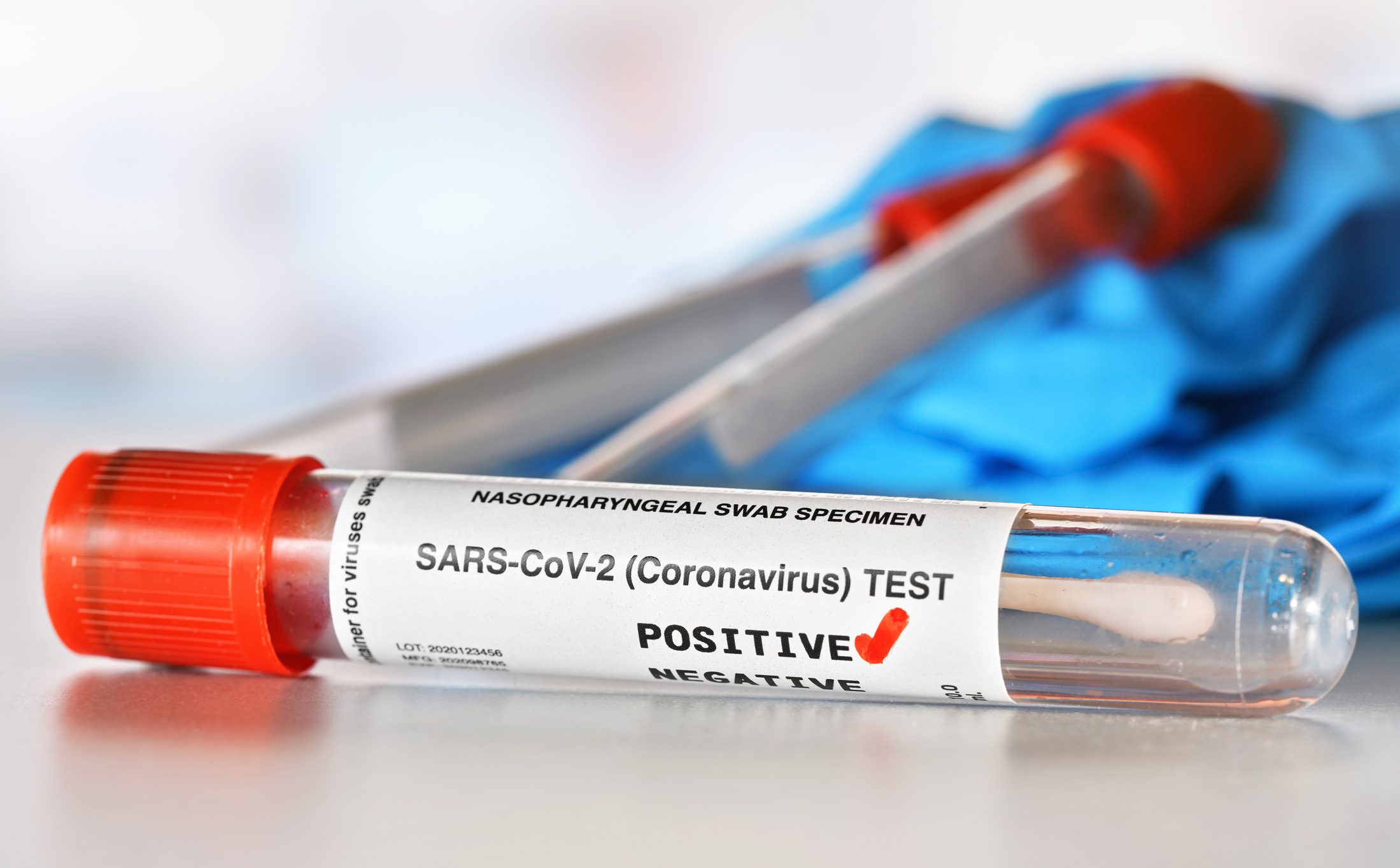 Concepto de prueba de coronavirus: tubo de muestra de vial con hisopo de algodón, marca de verificación roja junto a la palabra positiva, viales borrosos y fondo de guantes de nitrilo azul. (La pegatina es de diseño propio con datos ficticios)