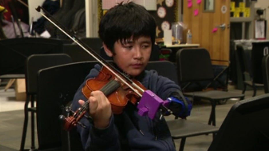 Local Engineering Students Create Prosthetic Arm for 6th Grade Musician