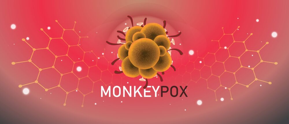 Monkeypox Being Spread Through Sexual Contact