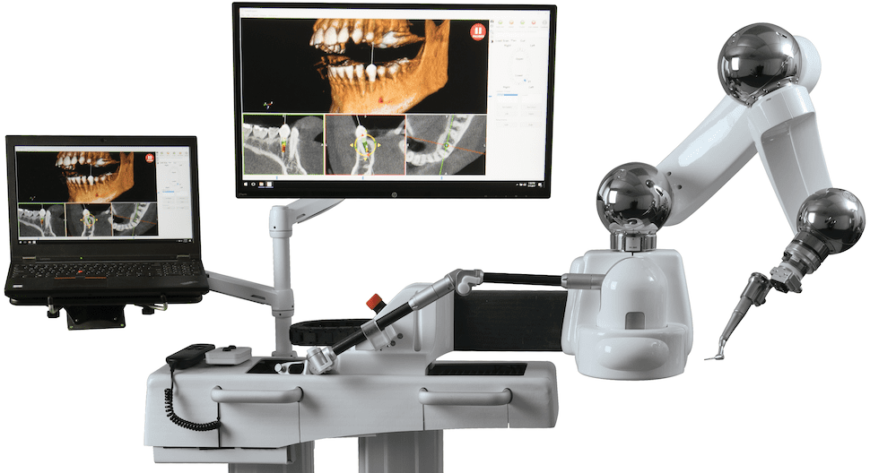 Robots Are Doing Dental Implants in DFW