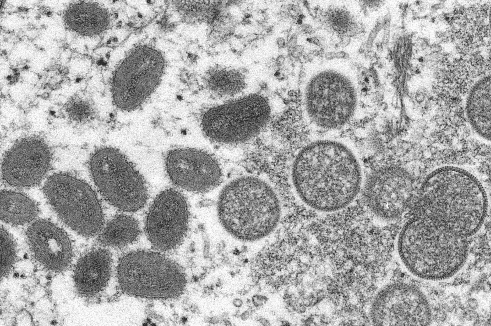 A electron microscope image made available by the Centers for Disease Control and Prevention shows mature, oval-shaped monkeypox virions