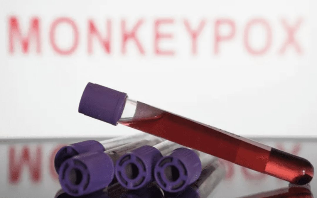 Local County Confirms Four Positive Monkeypox Cases