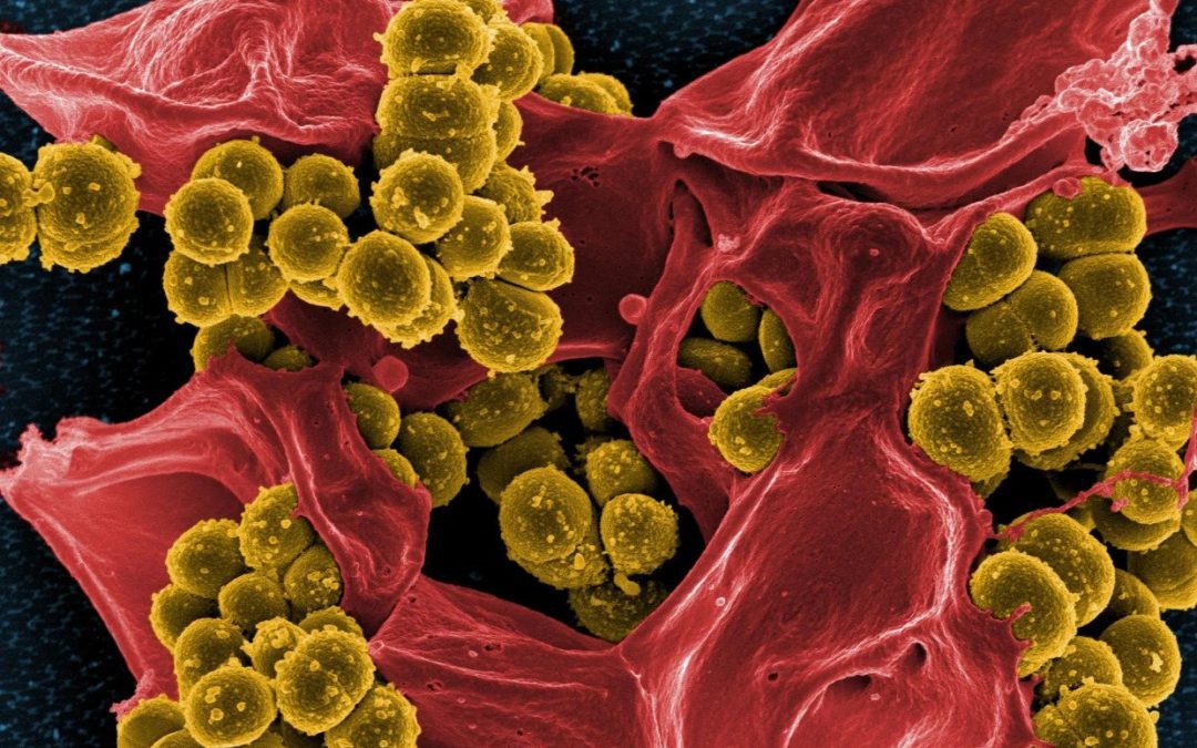 Los CDC informan infecciones por 'superbacterias' durante la pandemia