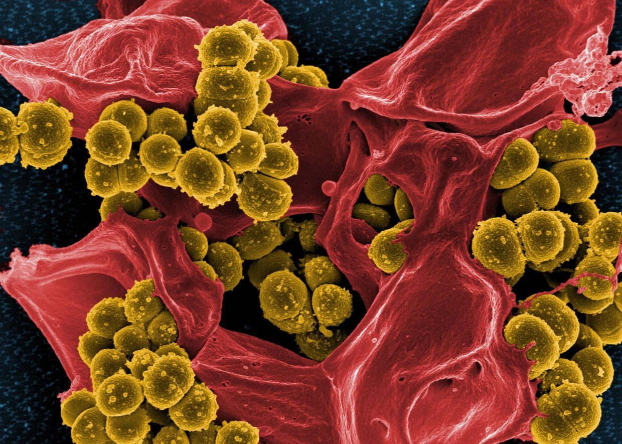 Superbug Infections, Deaths Increased During Pandemic