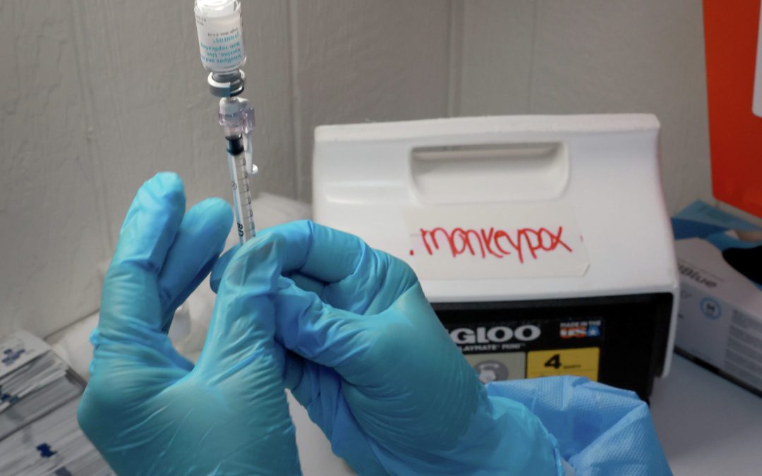 Texas’ First Presumptive Monkeypox Case in Child Under Two