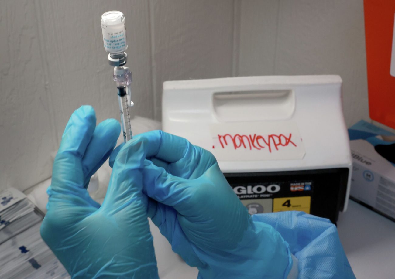 Texas' First Presumptive Monkeypox Case in Child Under Two