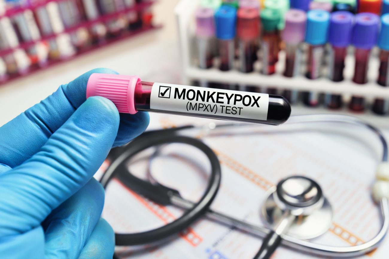 Local County Confirms 14 Monkeypox Cases 