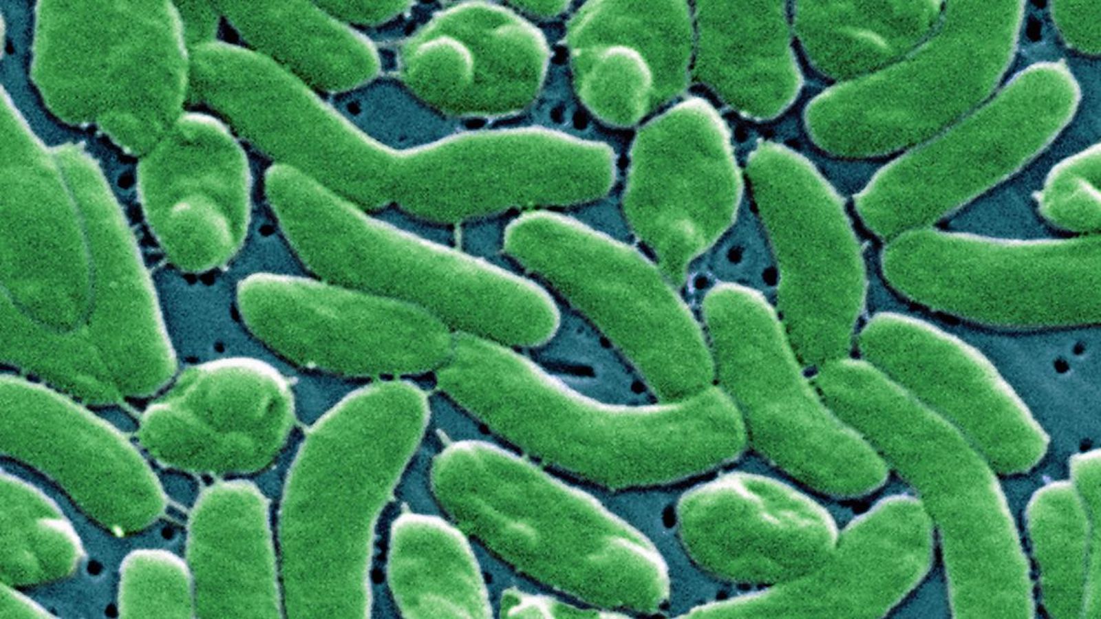 Flesh-Eating Bacteria Spike in Florida