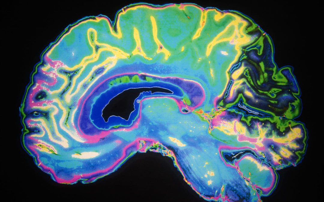 New Methods for Early Alzheimer’s Detection
