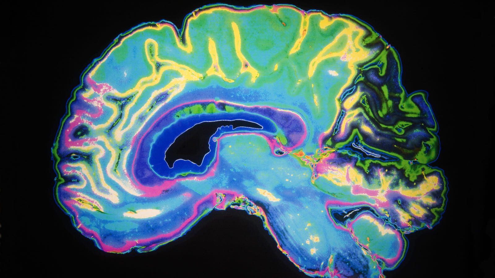 New Methods for Early Alzheimer's Detection