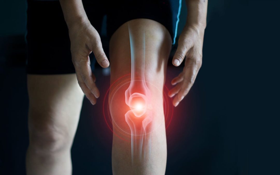Rethinking the Benefits of Knee Surgery