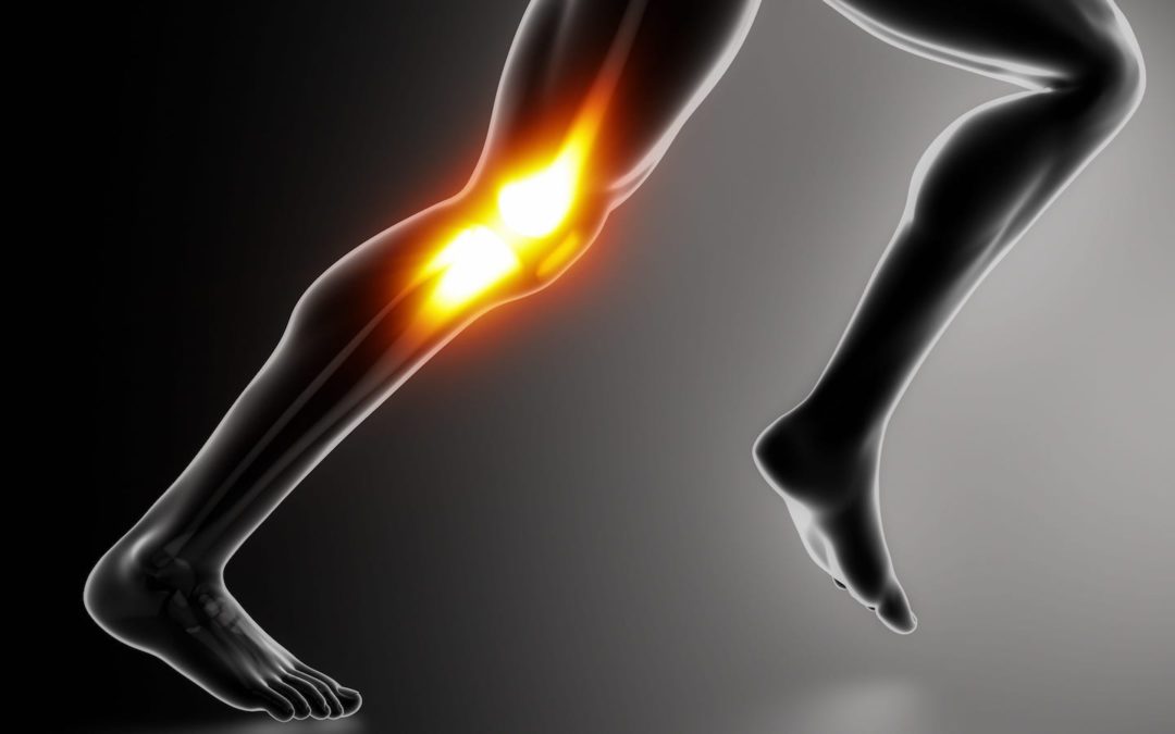 Study: No Correlation Between Physical Activity and Knee Revision Surgery