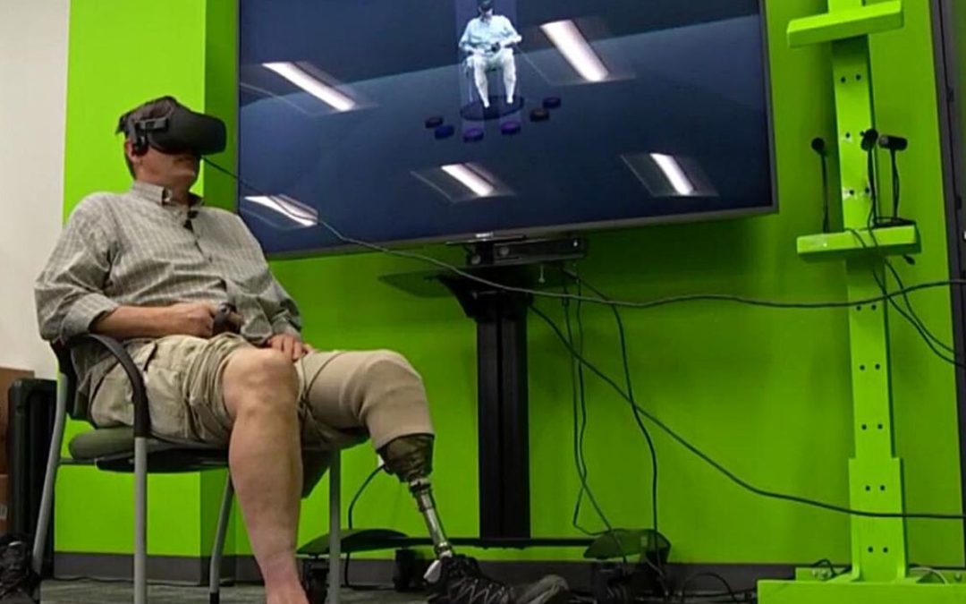 New VR Therapy Helps Relieve Phantom Limb Pain