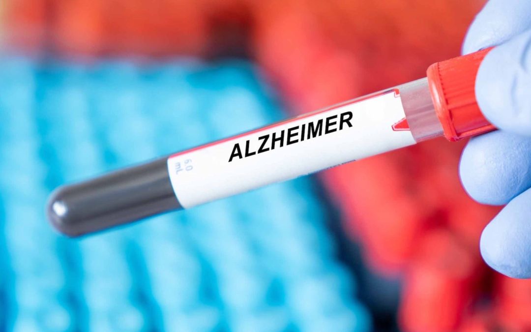 New Blood Test Identifies Alzheimer’s