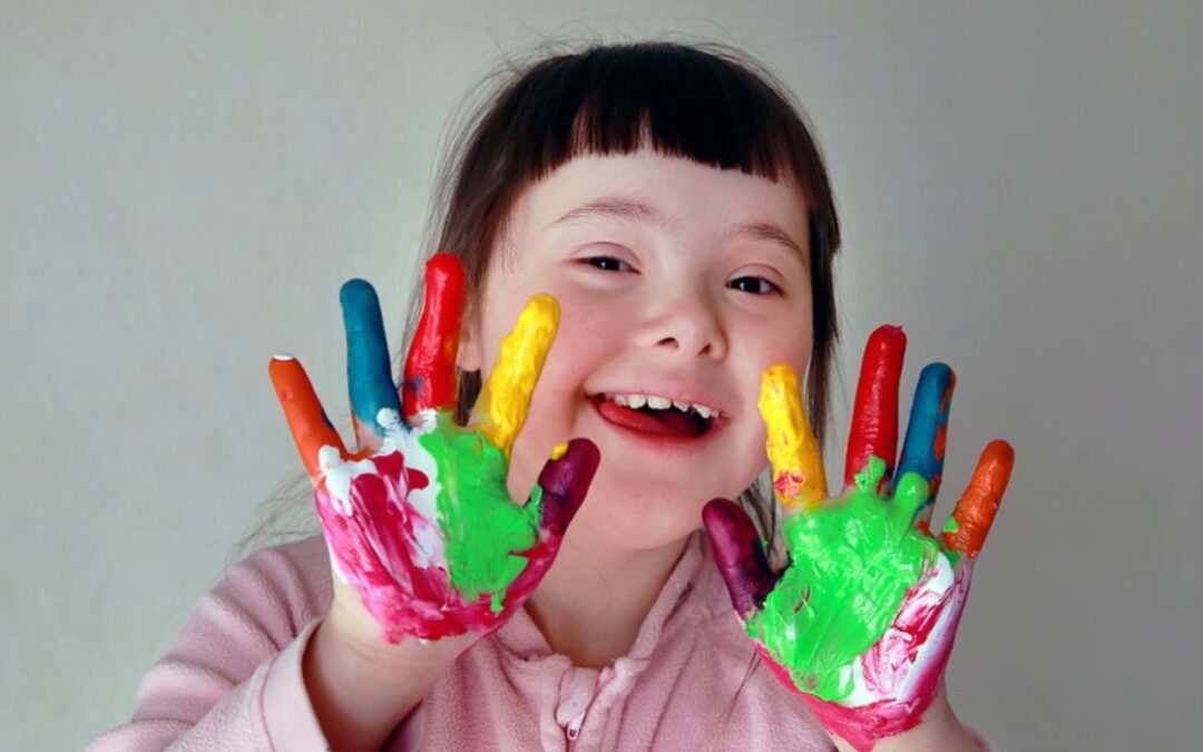 World Down Syndrome Day Arrives