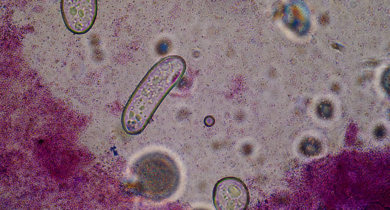 flesh-eating bacteria