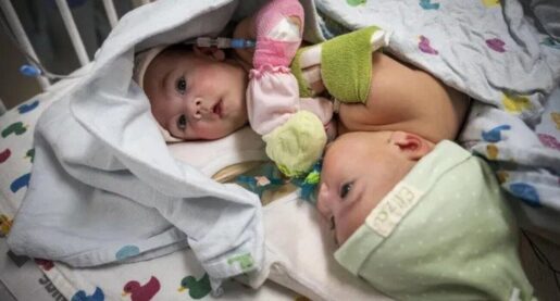 Twins Going Home After Separation Surgery