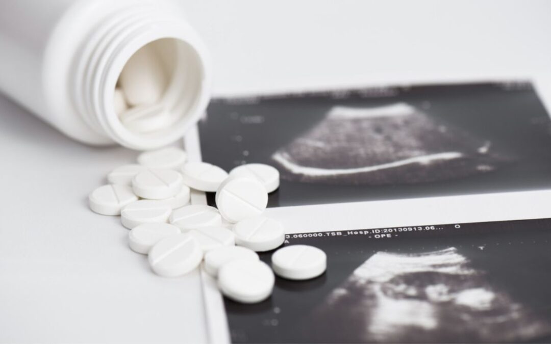 Píldoras abortivas embudo Blue States a Texas