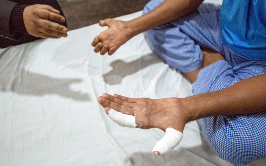 Leprosy Cases on the Rise