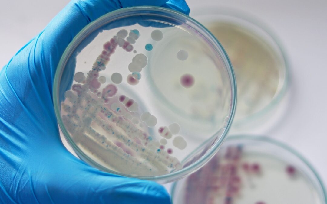 CDC Says Cases of Flesh-Eating Bacteria Increasing