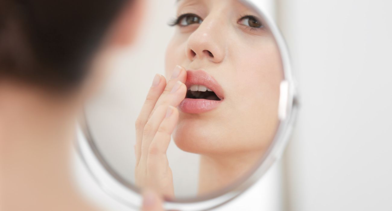 Woman looking at cold sore in mirror