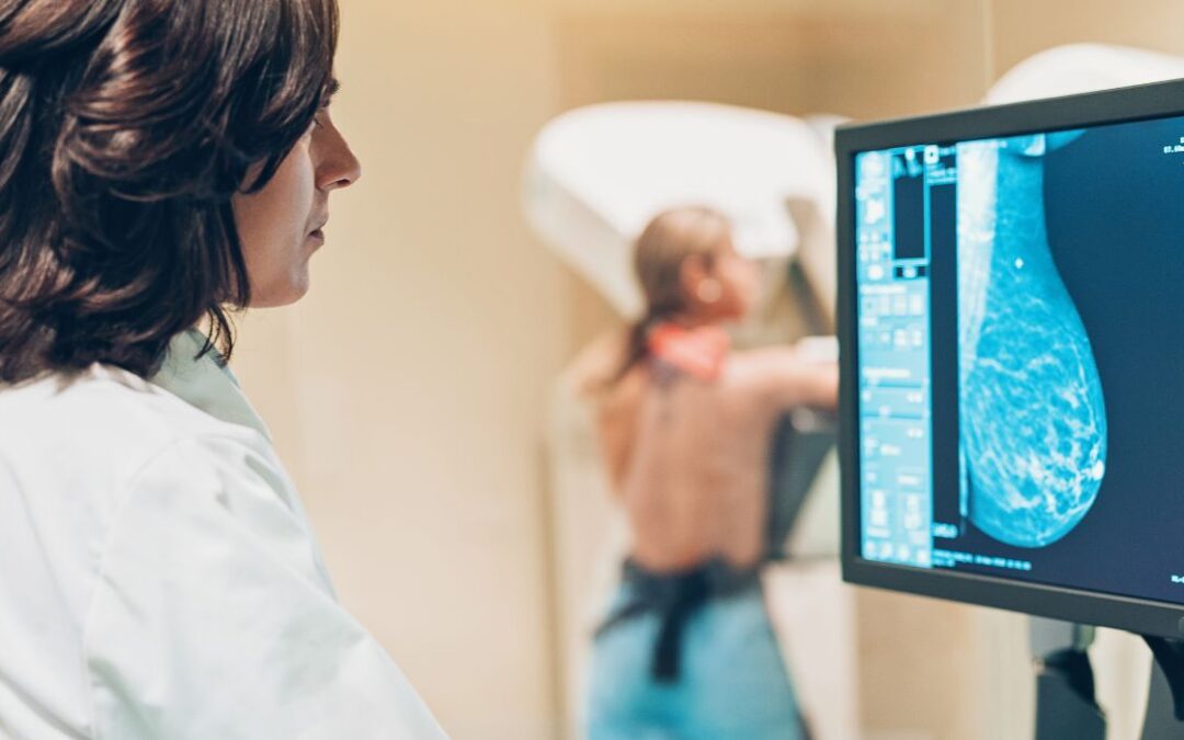 Get Checked Earlier: Women Need Earlier Mammograms
