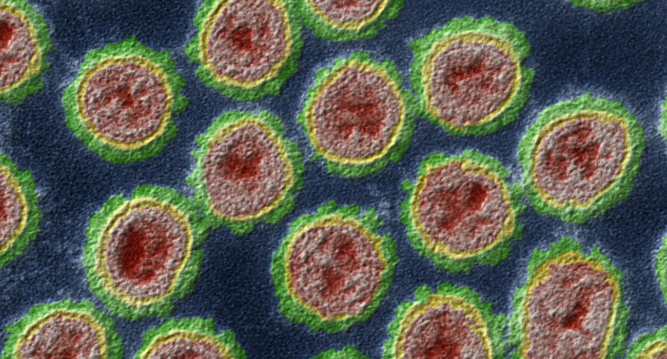 A color-enhanced transmission electron microscope image of bird flu viruses. | Image by Eye of Science/Science Source