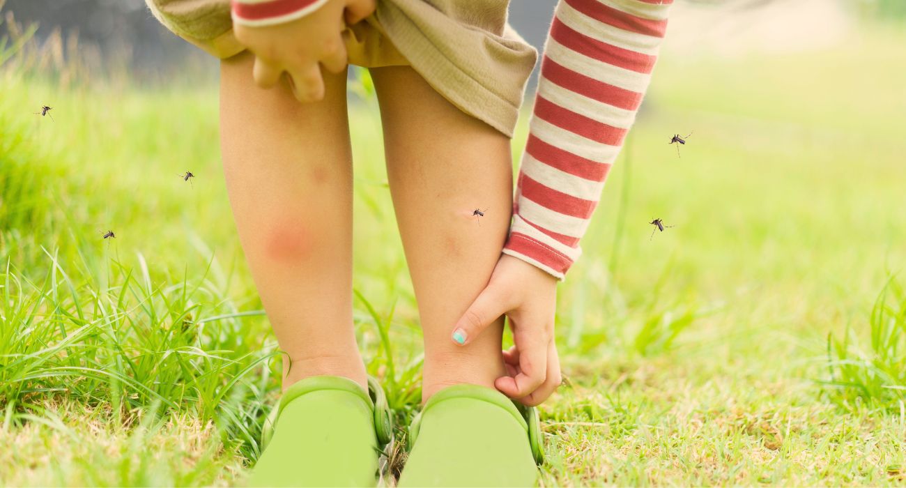 Mosquito bites on girl
