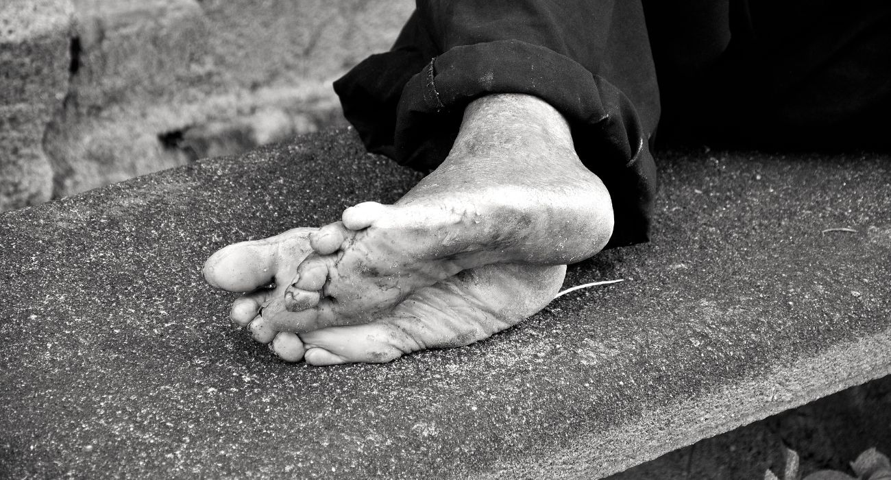 Barefoot homeless man