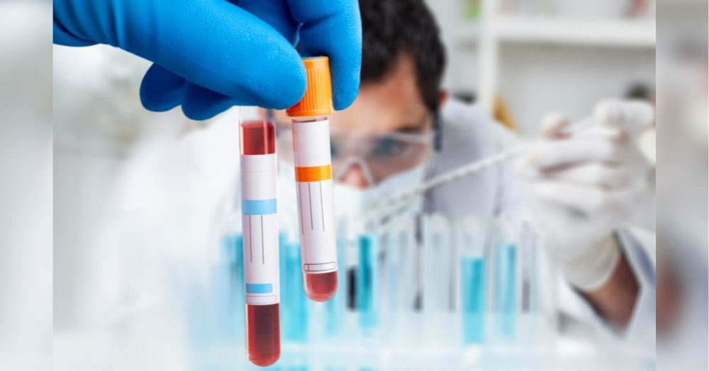 New FDA-Approved Blood Test Can Spot Colon Cancer