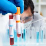 New FDA-Approved Blood Test Can Spot Colon Cancer