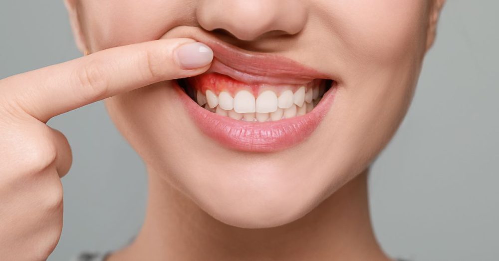 Steer Clear of ‘Dangerous’ TikTok Dentistry