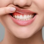 Steer Clear of ‘Dangerous’ TikTok Dentistry