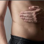 Trafficking For The Purpose Of Organ Removal Is On The Rise