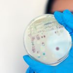 Floridians Warned Of Flesh-Eating Bacteria Danger