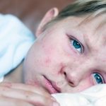 Texas Measles Outbreak Worsens