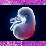 Vaccine Trial Results In Cancer Remissions