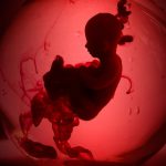 Paxton Secures Injunction To Shut Down Houston-Area Abortion Clinics