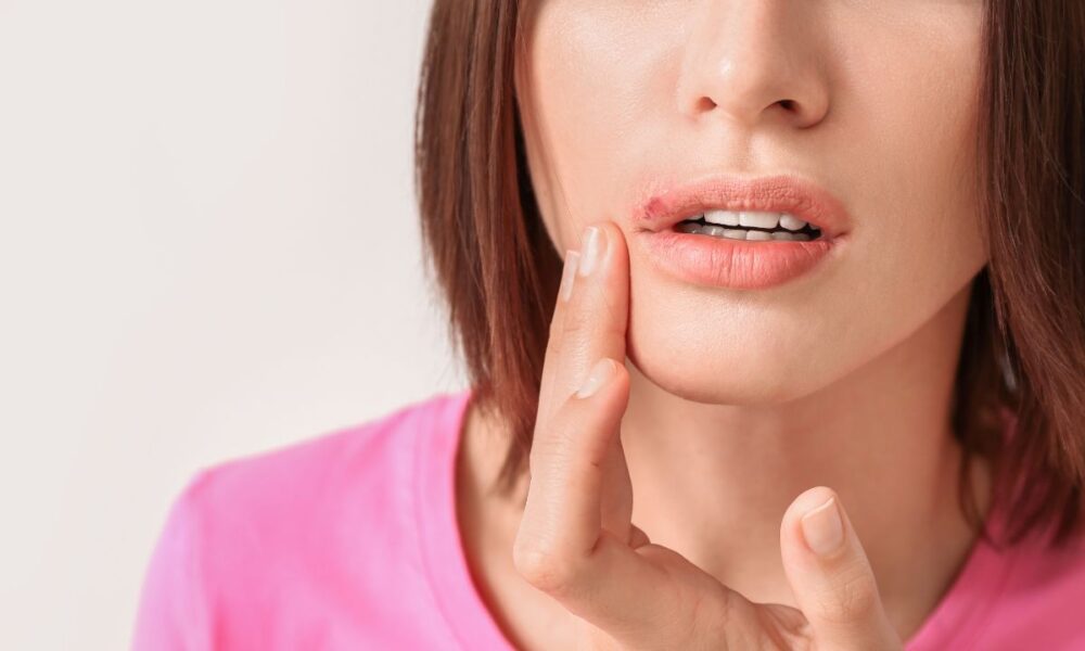 Study Links Herpes Virus To Alzheimer’s Risk, But Experts Urge Caution