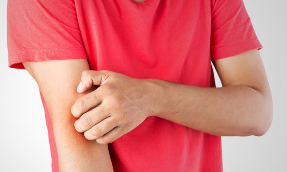 Here’s Why Mosquitoes Might Like You More