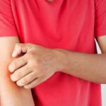 Here’s Why Mosquitoes Might Like You More
