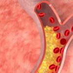 Hope For Healthy Hearts: Enzyme Breakthrough Could Tame Cholesterol