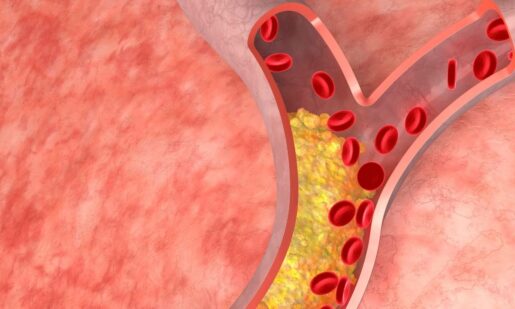 Hope For Healthy Hearts: Enzyme Breakthrough Could Tame Cholesterol