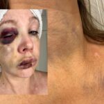 “They Begged for It”: Cincinnati Councilwoman’s Repulsive Defense Of Mob Attack Ignites Disgust