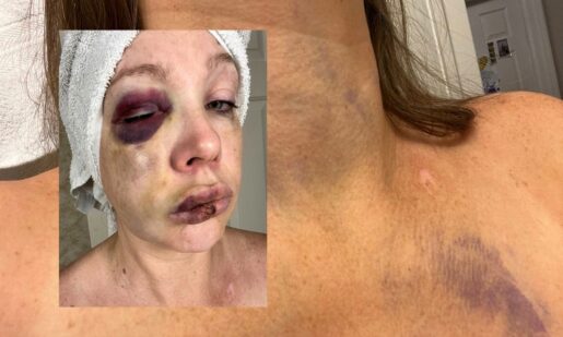 “They Begged for It”: Cincinnati Councilwoman’s Repulsive Defense Of Mob Attack Ignites Disgust