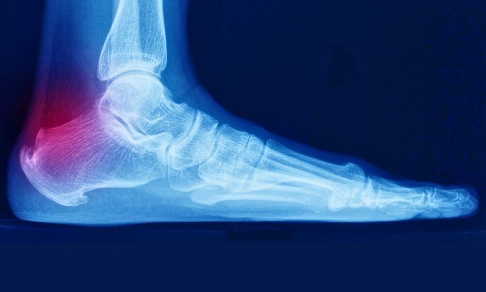 What’s Behind The Rise Of Radiation Therapy For Non-Cancer Health Issues?