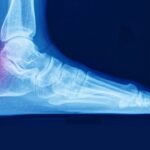 What’s Behind The Rise Of Radiation Therapy For Non-Cancer Health Issues?