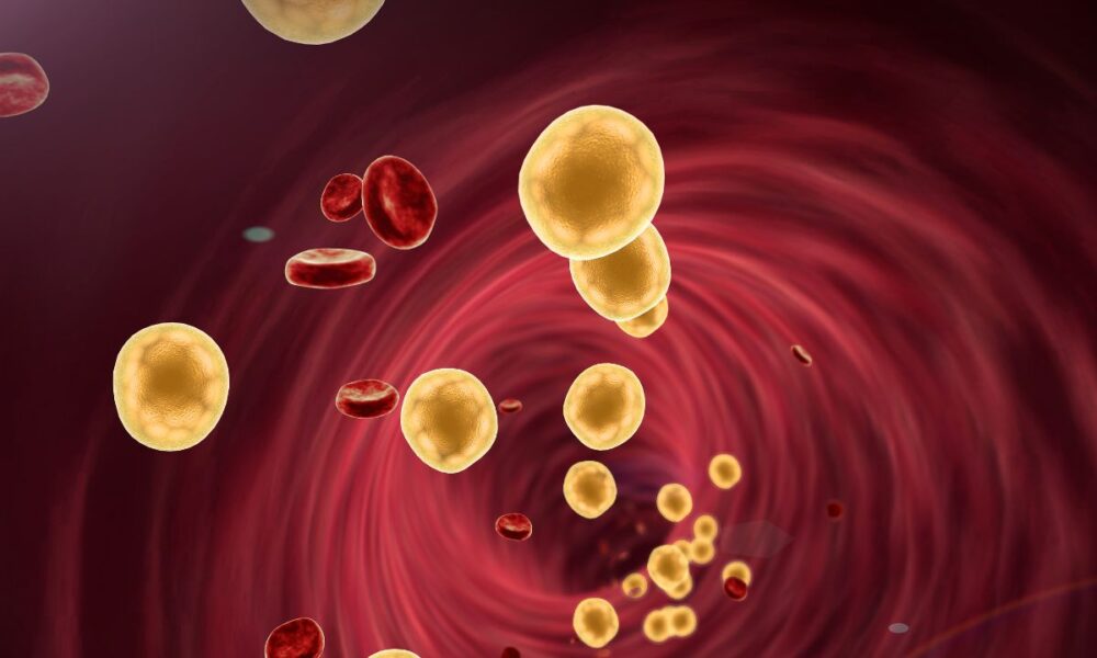 Study: CRISPR Cuts Cholesterol In Half With One Shot