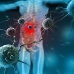 New Breakthroughs In Autoimmune Disease Treatment: CAR-T, mRNA & More
